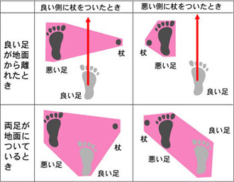 一本杖歩行の原理 一本杖歩行の原理