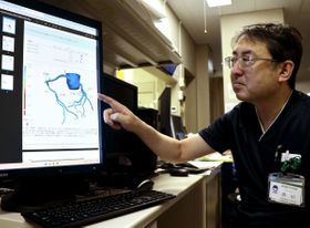 上越地域初、スパコンで心臓のＣＴ画像解析　県立中央病院（上越市）が導入、狭心症などの検査負担軽減